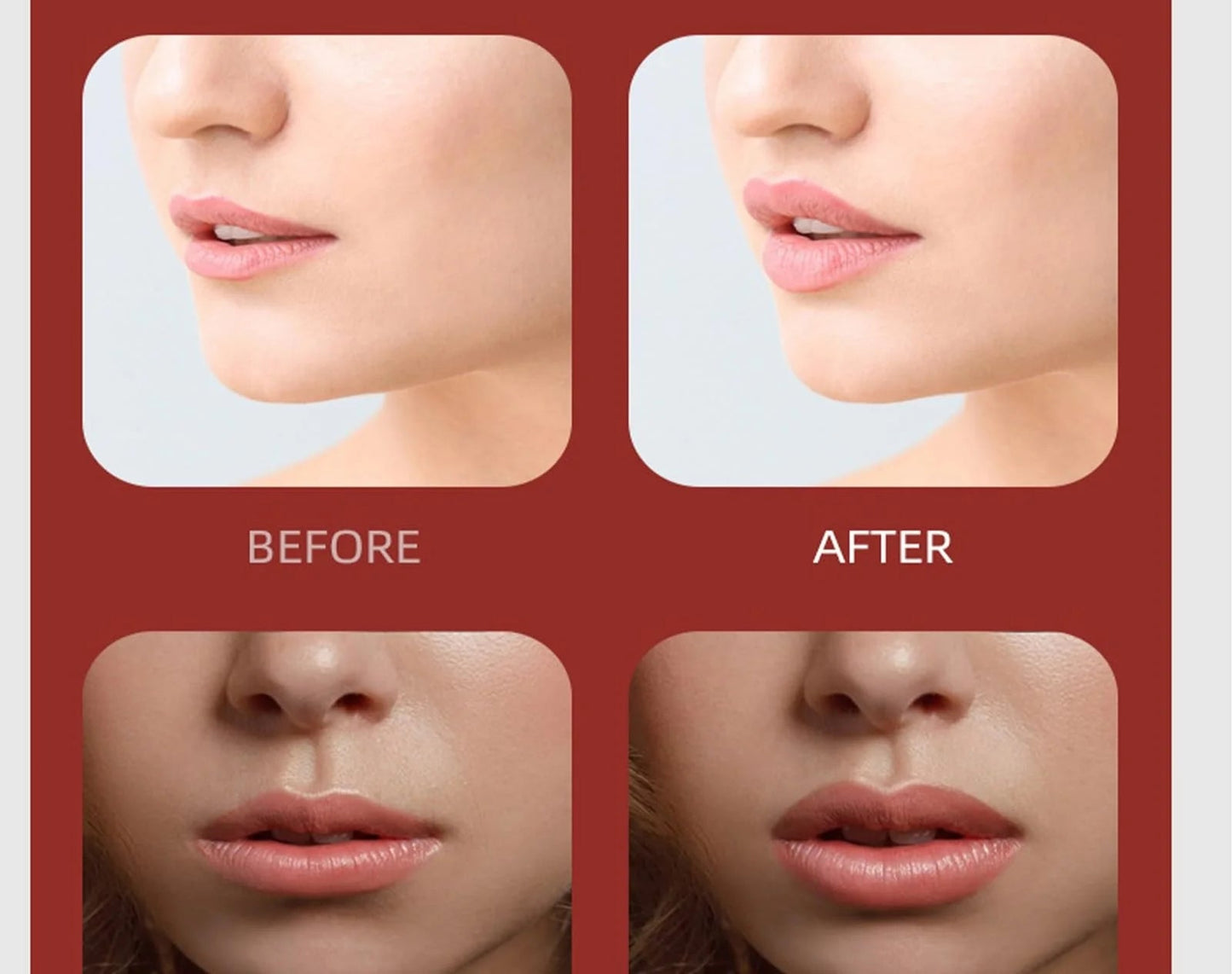 Professional Lip Plumper Device
