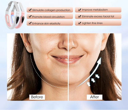 Face Lifting & Slimming Red Light Massager