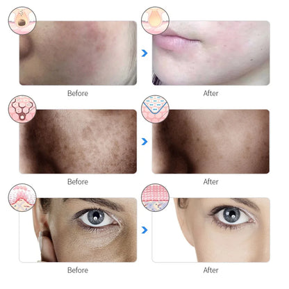 7 Color Red Light Therapy Facial Mask